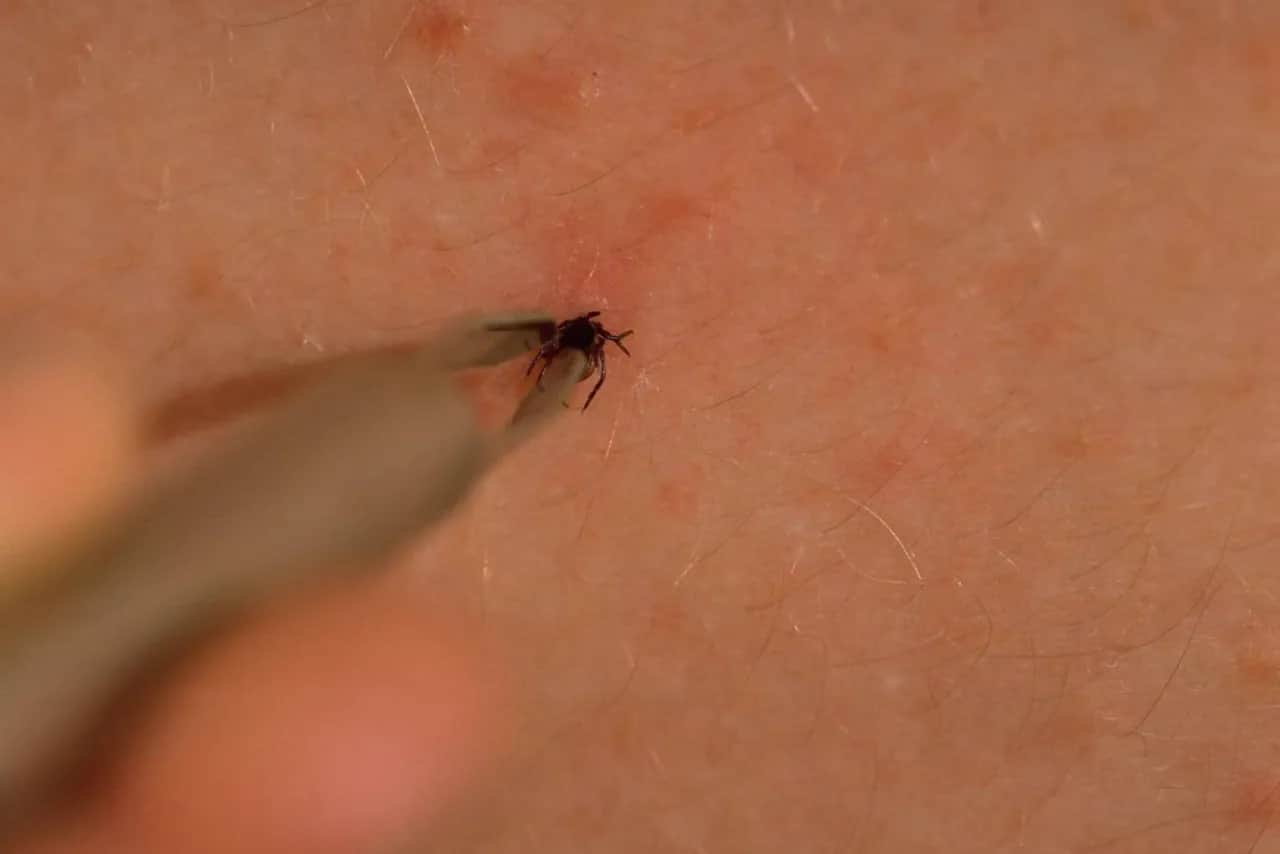 Jak bezpiecznie usunąć kleszcza? Sprawdź instrukcję krok po kroku